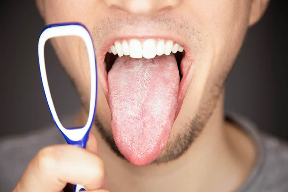 manchas blancas en la lengua causas