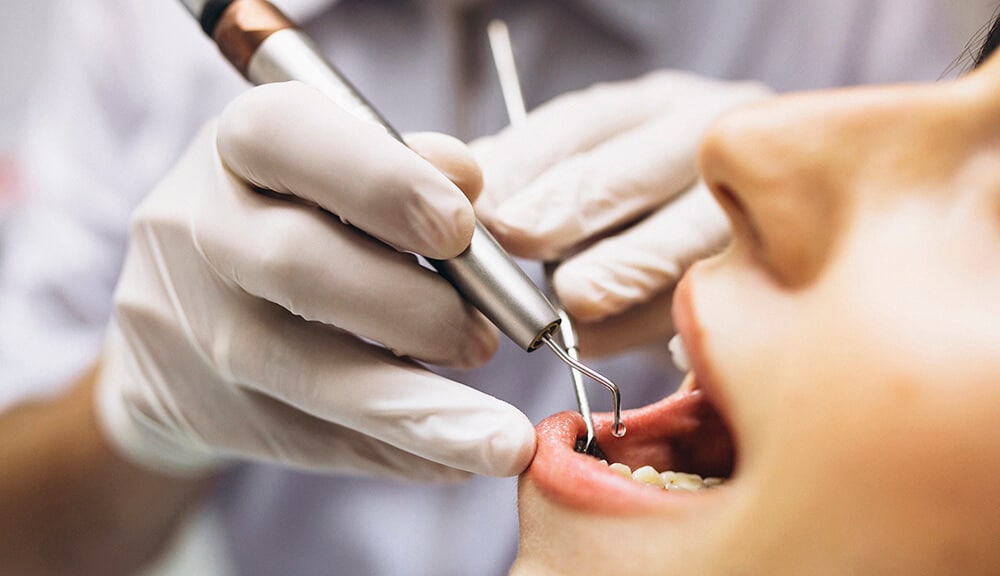 cómo tratar la piorrea periodontitis