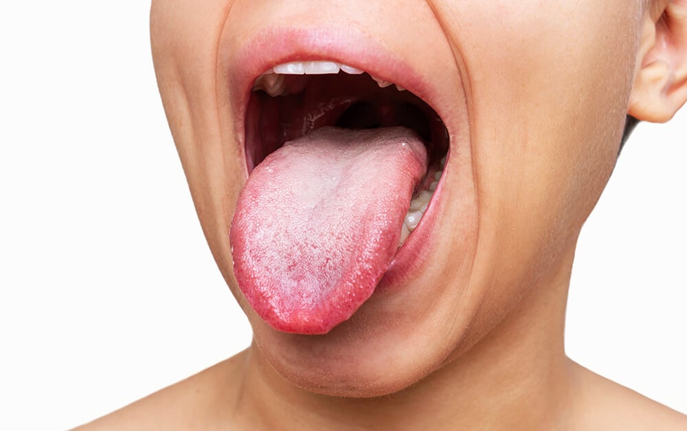 cómo limpiar lengua correctamente