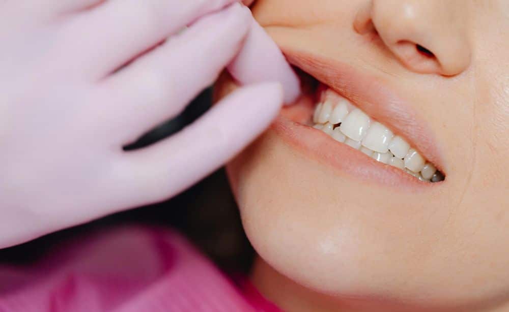 Profilaxis dental