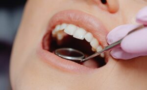Maloclusión dental información